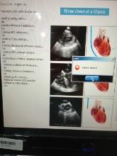 ImaCor ZT-1000 Zura-EVO Hemodynamic Ultrasound - 323880